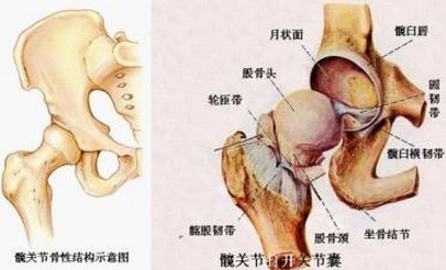 三期股骨头坏死有哪些症状